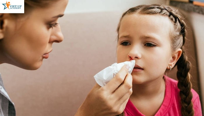Trẻ nên làm gì khi bị chảy máu cam?